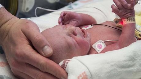 The first baby born from a transplanted uterus in the United States