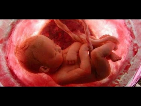 الفيديو المدهش للطبيب الذي حوّل الجنين من الخارج حتى يتمكن من الولادة في المنزل